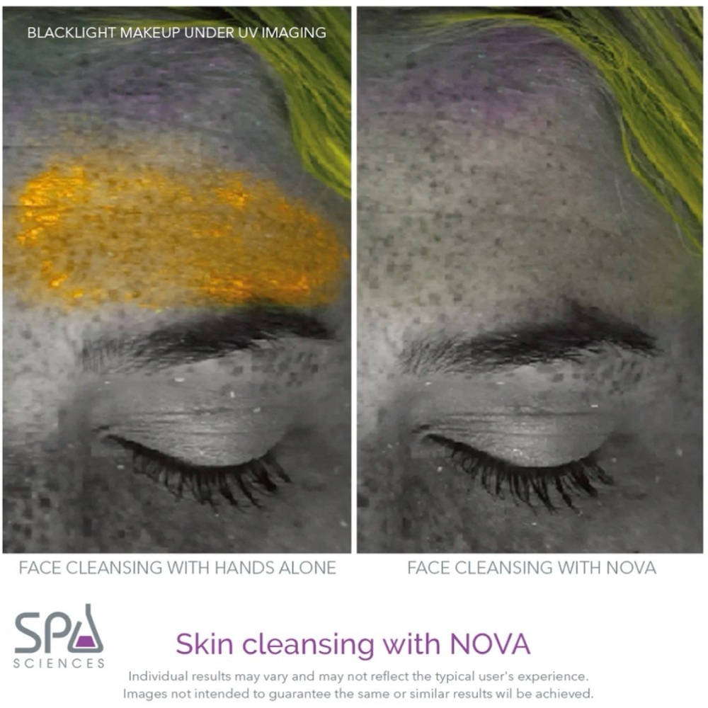 Nova Sonic Facial Cleansing Brush - Picture 12 of 12